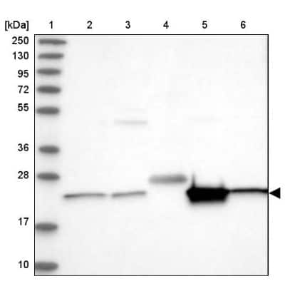 Western Blot: CDC123 Antibody [NBP1-88540] - Lane 1: Marker  [kDa] 250, 130, 95, 72, 55, 36, 28, 17, 10.  Lane 2: Human cell line RT-4.  Lane 3: Human cell line U-251MG sp.  Lane 4: Human plasma (IgG/HSA depleted).  Lane 5: Human liver tissue.  Lane 6: Human tonsil tissue