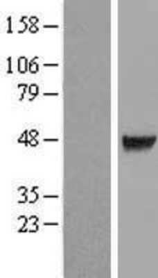 Western Blot: CDC123 Overexpression Lysate (Adult Normal) [NBL1-08987] Left-Empty vector transfected control cell lysate (HEK293 cell lysate); Right -Over-expression Lysate for CDC123.