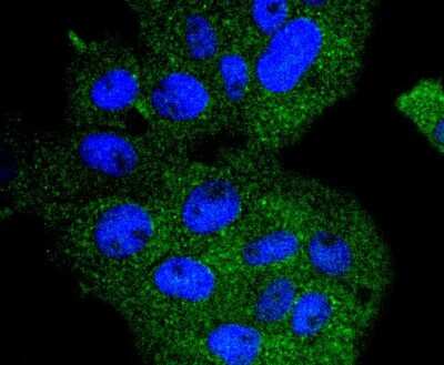 Immunocytochemistry/Immunofluorescence: CDC16 Antibody (SD085-8) [NBP2-67820] - Staining APC6 in RH-35 cells (green). The nuclear counter stain is DAPI (blue). Cells were fixed in paraformaldehyde, permeabilised with 0.25% Triton X100/PBS.