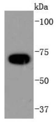 Western Blot: CDC16 Antibody (SD085-8) [NBP2-67820] - Analysis of APC6 on Hela cells lysates using anti-APC6 antibody at 1/1,000 dilution.