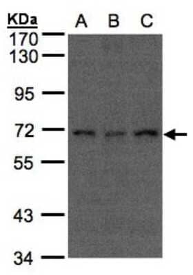 Western Blot: CDC16 Antibody [NBP1-32182] - Sample(30 ug of whole cell lysate)A:A431 B:H1299C:HeLa S3 7. 5% SDS PAGE, antibody diluted at 1:500.