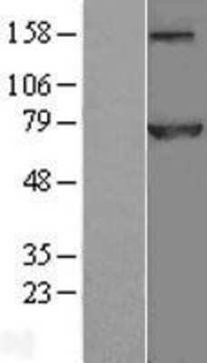 Western Blot: CDC16 Overexpression Lysate (Adult Normal) [NBL1-08989] Left-Empty vector transfected control cell lysate (HEK293 cell lysate); Right -Over-expression Lysate for CDC16.