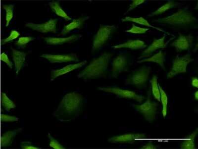 Immunocytochemistry/Immunofluorescence: CDC2/CDK1 Antibody (1G10) [H00000983-M03] - Analysis of monoclonal antibody to CDC2 on HeLa cell. Antibody concentration 10 ug/ml