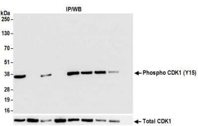 Immunoprecipitation: CDC2/CDK1 Antibody [NBP3-14693] - Whole cell lysate (1.0 mg per IP reaction; 20% of IP loaded) from HeLa cells treated with Hydroxyurea (+) or mock treated (-). Antibodies:Rabbit anti-Phospho CDK1 (Y15) recombinant monoclonalantibody used for IP at 20 ul/mg lysate. Total CDK1 was immunoprecipitated byRabbit anti-CDK1 recombinant monoclonal antibody. Immunoprecipitates where treatedwith phosphatase (+) or mock treated (-). For blottingimmunoprecipitated Phospho CDK1 (Y15), wasused at 1:1000. Chemiluminescence with an exposure timeof 10 seconds. Lower panel shows WB for total CDK1 usingrabbit anti-CDK1 recombinant monoclonal.