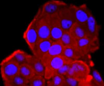 Immunocytochemistry/Immunofluorescence: CDC2/CDK1 Antibody (SM01-44) [NBP2-66764] - Staining CDK1 in Hela cells (red). The nuclear counter stain is DAPI (blue). Cells were fixed in paraformaldehyde, permeabilised with 0.25% Triton X100/PBS.