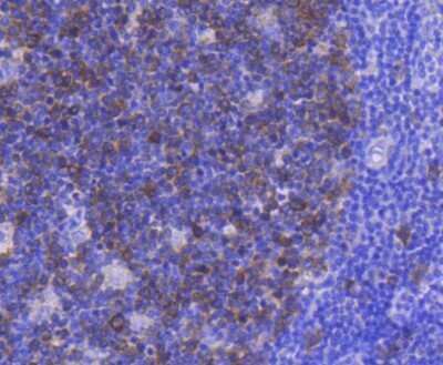 Immunohistochemistry-Paraffin: CDC2/CDK1 Antibody (SM01-44) [NBP2-67438] - Analysis of paraffin-embedded human tonsil tissue using anti-CDK1 antibody. Counter stained with hematoxylin.