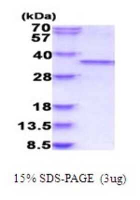 SDS-Page: CDC2/CDK1 Recombinant Protein [NBP2-51886] - 15% SDS Page (3 ug)