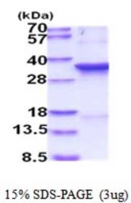 SDS-Page: Recombinant Human CDC2/CDK1 Protein [NBP2-52017] -  15% SDS Page (3 ug)