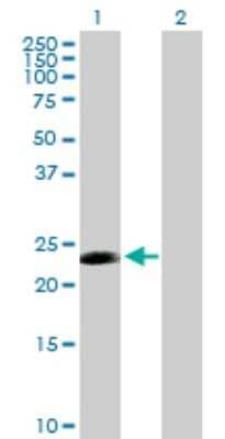 Western Blot: CDC20B Antibody [H00166979-B01P] - Analysis of CDC20B expression in transfected 293T cell line by CDC20B polyclonal antibody.  Lane 1: FLJ37927 transfected lysate(21.12 KDa). Lane 2: Non-transfected lysate.