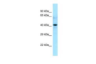 Western Blot: CDC20B Antibody [NBP2-87164] - Host: Rabbit. Target Name: CDC20B. Sample Type: 293T Whole Cell lysates. Antibody Dilution: 1.0ug/ml