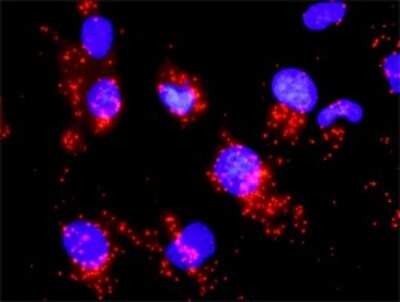 Proximity Ligation Assay: CDC25A Antibody (3D5) [H00000993-M01] - Analysis of protein-protein interactions between CCNB1 and CDC25A. Mahlavu cells were stained with anti-CCNB1 rabbit purified polyclonal 1:1200 and anti-CDC25A mouse monoclonal antibody 1:50. Each red dot represents the detection of protein-protein interaction complex, and nuclei were counterstained with DAPI (blue).