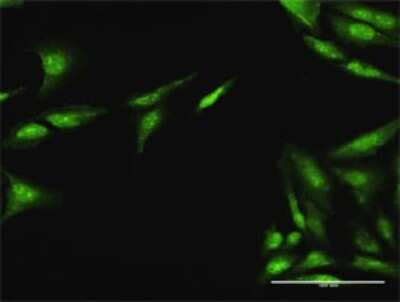 Immunocytochemistry/Immunofluorescence: CDC25A Antibody [H00000993-D01P] - Analysis of antibody to CDC25A on HeLa cell. Antibody concentration 20 ug/ml.