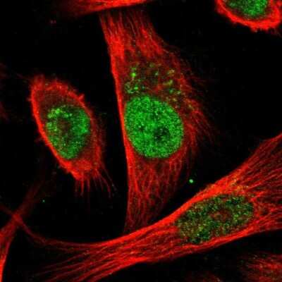 Immunocytochemistry/Immunofluorescence: CDC25A Antibody [NBP1-86506] - Immunofluorescent staining of human cell line U-251 MG shows localization to nucleoplasm & the Golgi apparatus.