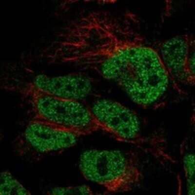 Immunocytochemistry/Immunofluorescence: CDC25A Antibody [NBP3-17816] - Staining of human cell line HAP1 shows localization to nucleoplasm.