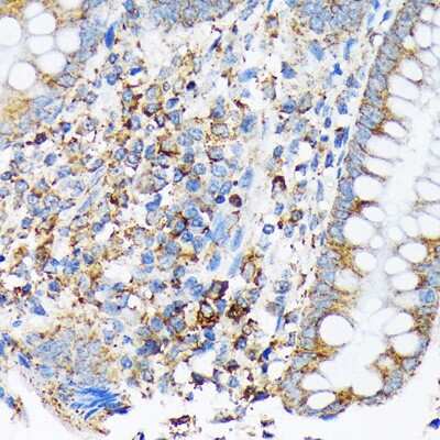 Immunohistochemistry-Paraffin: CDC25B Antibody (4D5S10) [NBP3-16877] - Immunohistochemistry of paraffin-embedded human appendix using CDC25B Rabbit mAb (NBP3-16877) at dilution of 1:100 (40x lens).Perform microwave antigen retrieval with 10 mM Tris/EDTA buffer pH 9.0 before commencing with IHC staining protocol.