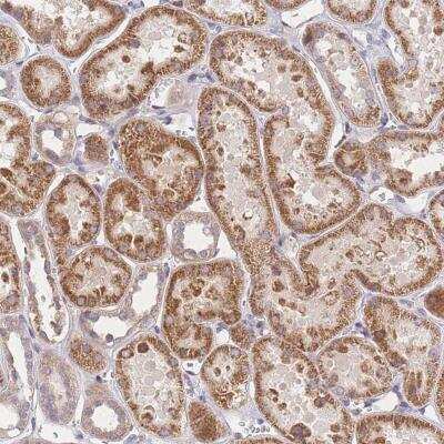 Immunohistochemistry: CDC25B Antibody [NBP2-32626] - Staining of human kidney shows moderate cytoplasmic positivity in cells in tubules.