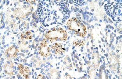 Immunohistochemistry-Paraffin: CDC25B Antibody [NBP1-58076] - Human kidney Tissue, antibody concentration 4-8ug/ml. Cells with positive label: renal corpuscle cells (indicated with arrows) 400X magnification.