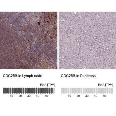 <b>Orthogonal Strategies Validation. </b>Immunohistochemistry-Paraffin: CDC25B Antibody [NBP2-32626] - Staining in human lymph node and pancreas tissues using anti-CDC25B antibody. Corresponding CDC25B RNA-seq data are presented for the same tissues.