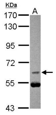 Western Blot: CDC25B Antibody [NBP2-15826] -  Sample (30 ug of whole cell lysate) A: U87-MG 7. 5% SDS PAGE gel, diluted at 1:1000.