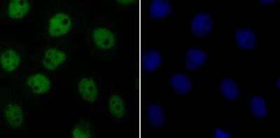 Immunocytochemistry/Immunofluorescence: CDC25C Antibody [NBP2-89147] - Staining Cdc25C in A431 cells (green). The nuclear counter stain is DAPI (blue). Cells were fixed in paraformaldehyde, permeabilised with 0.25% Triton X100/PBS.