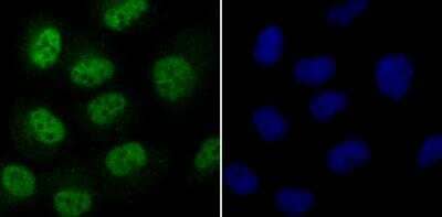 Immunocytochemistry/Immunofluorescence: CDC25C Antibody [NBP2-89147] - Staining Cdc25C in HUVEC cells (green). The nuclear counter stain is DAPI (blue). Cells were fixed in paraformaldehyde, permeabilised with 0.25% Triton X100/PBS.