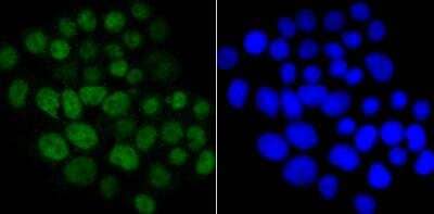 Immunocytochemistry/Immunofluorescence: CDC25C Antibody [NBP2-89147] - Staining Cdc25C in LOVO cells (green). The nuclear counter stain is DAPI (blue). Cells were fixed in paraformaldehyde, permeabilised with 0.25% Triton X100/PBS.