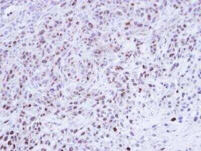 Immunohistochemistry-Paraffin: CDC25C Antibody [NBP1-33687] -  Paraffin-embedded SAS xenograft, using antibody at 1:500 dilution.