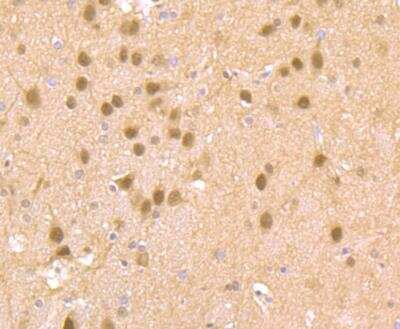 Immunohistochemistry-Paraffin: CDC25C Antibody [NBP2-89147] - Analysis of paraffin-embedded rat brain tissue using anti-Cdc25C antibody. Counter stained with hematoxylin.