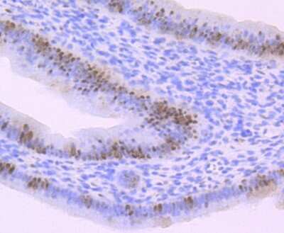 Immunohistochemistry-Paraffin: CDC25C Antibody [NBP2-89147] - Immunohistochemical analysis of paraffin-embedded mouse uterus tissue using anti-CDC25C antibody. Counter stained with hematoxylin.