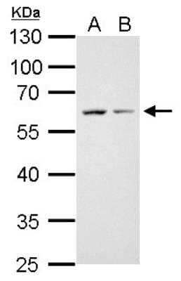 Western Blot: CDC25C Antibody [NBP1-33687] -  A. 30 ug Raw264. 7 whole cell lysate/extract, B. 30 ug C2C12 whole cell lysate/extract 10 % SDS-PAGE gel, antibody dilution 1:1000.
