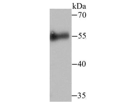 Western Blot: CDC25C Antibody [NBP2-89147] - Analysis of Cdc25C on human skin tissue lysate using anti-Cdc25C antibody at 1/500 dilution.