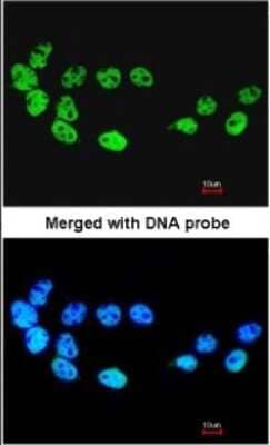 Immunocytochemistry/Immunofluorescence: CDC26 Antibody [NBP1-33112] - Paraformaldehyde-fixed A431, using antibody at 1:200 dilution.