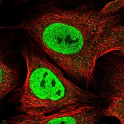 Immunocytochemistry/ Immunofluorescence CDC26 Antibody