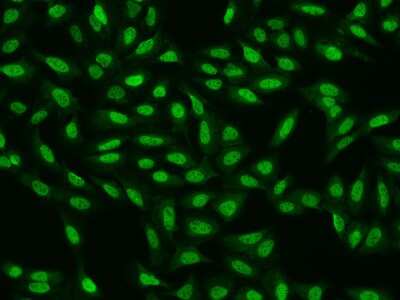 Immunocytochemistry/Immunofluorescence: CDC26 Antibody [NBP2-97346] - Immunofluorescence staining of CDC26 in U2OS cells. Cells were fixed with 4% PFA, permeabilzed with 0.1% Triton X-100 in PBS, blocked with 10% serum, and incubated with rabbit anti-Human CDC26 polyclonal antibody (dilution ratio 1:200) at 4C overnight. Then cells were stained with the Alexa Fluor(R)488-conjugated Goat Anti-rabbit IgG secondary antibody (green). Positive staining was localized to Nucleus.