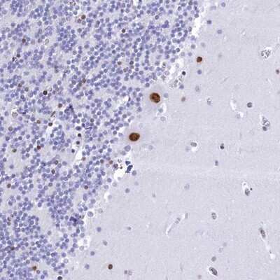 Immunohistochemistry-Paraffin CDC26 Antibody