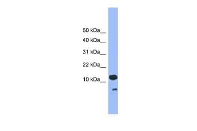 Western Blot: CDC26 Antibody [NBP2-84638] - WB Suggested Anti-CDC26 Antibody Titration: 0.2-1 ug/ml. ELISA Titer: 1:1562500. Positive Control: Human Placenta