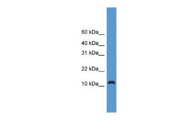 Western Blot: CDC26 Antibody [NBP2-84639] - WB Suggested Anti-CDC26 Antibody Titration: 0.2-1 ug/ml. ELISA Titer: 1:1562500. Positive Control: A549 cell lysate