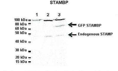 Western Blot: CDC26 Antibody [NBP2-84639] - Lanes: 1: 20ug Jukart cell lysate, 2: 20ug untransfected Hela lysate, 3: 20ug GFP-STAMBP transfected HeLa lysate. Primary Antibody Dilution: 1:1000. Secondary Antibody: Goat anti-rabbit-HRP. Secondary Antibody Dilution: 1:2000. Gene Name: CDC26. Submitted by: Dr. N. Blake, University of Liverpool. 