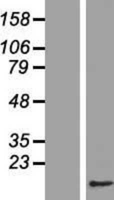 Western Blot: CDC26 Overexpression Lysate (Adult Normal) [NBL1-08997] Left-Empty vector transfected control cell lysate (HEK293 cell lysate); Right -Over-expression Lysate for CDC26.