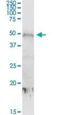 Western Blot: CDC2L6 Antibody [H00023097-D01P] - Analysis of CDC2L6 expression in human placenta.