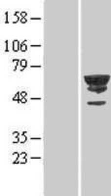 Western Blot: CDC2L6 Overexpression Lysate (Adult Normal) [NBL1-09000] Left-Empty vector transfected control cell lysate (HEK293 cell lysate); Right -Over-expression Lysate for CDC2L6.