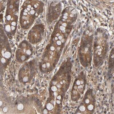 Immunohistochemistry-Paraffin: CDC37 Antibody [NBP1-80960] - Staining of human duodenum shows moderate cytoplasmic positivity in glandular cells.