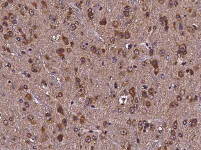 Immunohistochemistry-Paraffin: CDC37 Antibody [NBP2-98122] - Immunochemical staining of mouse CDC37 in mouse brain with rabbit polyclonal antibody (1:10000, formalin-fixed paraffin embedded sections).