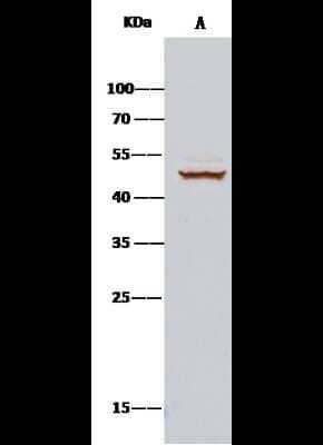 Immunoprecipitation: CDC37 Antibody [NBP2-98122] - Mouse CDC37 was immunoprecipitated using: Lane A: 0.5 mg HepG2 Whole Cell Lysate 2 ul anti-Mouse CDC37 rabbit polyclonal antibody and 15 ul of 50 % Protein G agarose. Primary antibody: Anti-Mouse CDC37 rabbit polyclonal antibody, at 1:200 dilution. Secondary antibody: Clean-Bloto IP Detection Reagent (HRP) at 1:1000 dilution. Developed using the DAB staining technique. Performed under reducing conditions. Predicted band size: 42 kDa. Observed band size: 48 kDa
