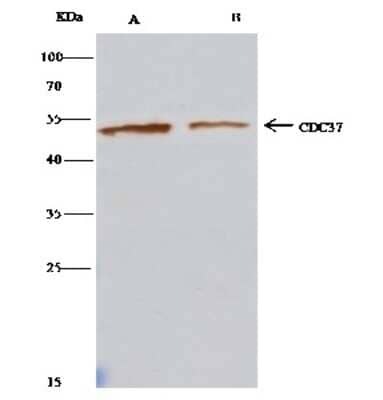 Immunoprecipitation: CDC37 Antibody [NBP2-99422] - CDC37 was immunoprecipitated using: Lane A: 0.5 mg Jurkat Whole Cell Lysate. Lane B: 0.5 mg A431 Whole Cell Lysate4 ul anti-CDC37 rabbit polyclonal antibody and 60 ug of Immunomagnetic beads Protein G. Primary antibody: Anti-CDC37 rabbit polyclonal antibody, at 1:100 dilution. Secondary antibody: Clean-Bloto IP Detection Reagent (HRP) at 1:500 dilution. Developed using the DAB staining technique. Performed under reducing conditions. Predicted band size: 44 kDa. Observed band size: 44 kDa