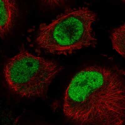 Immunocytochemistry/Immunofluorescence: CDC40 Antibody [NBP2-58541] - Staining of human cell line U-251 MG shows localization to nucleoplasm.