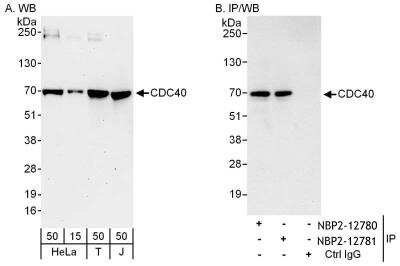 Immunoprecipitation: CDC40 Antibody [NBP2-12780] - Samples: Whole cell lysate from HeLa (15 and 50 ug for WB; 1 mg for IP, 20% of IP loaded), 293T (T; 50 ug) and Jurkat (J; 50 ug) cells. Antibodies: Affinity purified rabbit anti-CDC40 antibody NBP2-12780 used for WB at 0.1 ug/ml (A) and 1 ug/ml (B) and used for IP at 6 ug/mg lysate. CDC40 was also immunoprecipitated by rabbit anti-CDC40 antibody NBP2-12781, which recognizes a downstream epitope. Detection: Chemiluminescence with exposure times of 3 minutes (A) and 10 seconds (B).