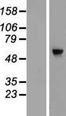 Western Blot: CDC40 Overexpression Lysate (Adult Normal) [NBP2-07106] Left-Empty vector transfected control cell lysate (HEK293 cell lysate); Right -Over-expression Lysate for CDC40.