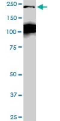 Western Blot: CDC42BPB Antibody (2D8) [H00009578-M04] - Analysis of CDC42BPB expression in Raw 264.7 (Cat # L024V1).