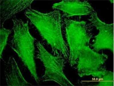 Immunocytochemistry/Immunofluorescence: CDC42BPB Antibody (5F12) [H00009578-M01] - Analysis of monoclonal antibody to CDC42BPB on HeLa cell . Antibody concentration 10 ug/ml.